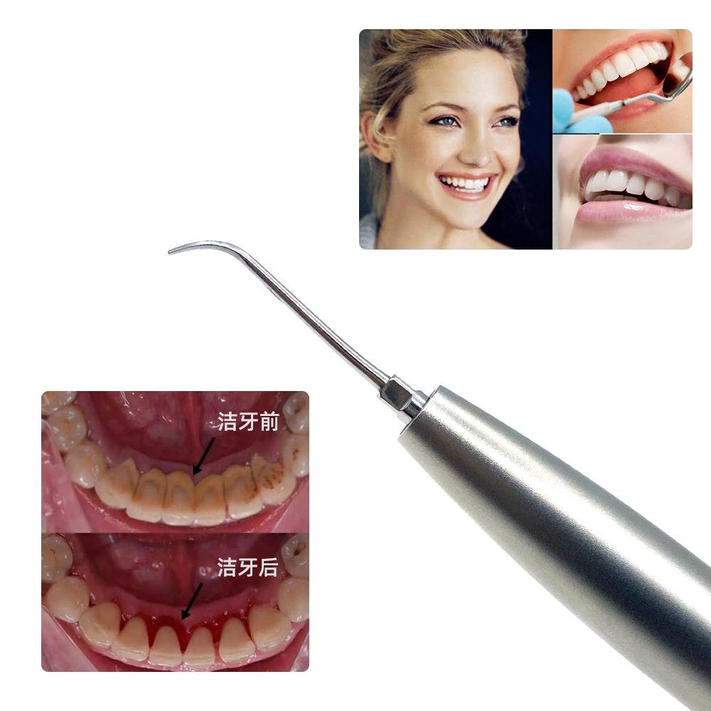Koop Tandheelkundige endodontische irrigatie Wortelkanaalluchtscaler. Tandheelkundige endodontische irrigatie Wortelkanaalluchtscaler Prijzen. Tandheelkundige endodontische irrigatie Wortelkanaalluchtscaler Brands. Tandheelkundige endodontische irrigatie Wortelkanaalluchtscaler Fabrikant. Tandheelkundige endodontische irrigatie Wortelkanaalluchtscaler Quotes. Tandheelkundige endodontische irrigatie Wortelkanaalluchtscaler Company.